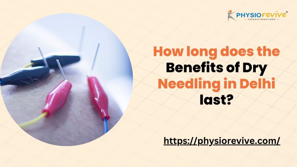 How long does the Benefits of Dry Needling in Delhi last?